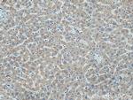 TMEM70 Antibody in Immunohistochemistry (Paraffin) (IHC (P))