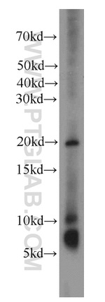TMEM70 Antibody in Western Blot (WB)