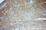 STAC3 Antibody in Immunohistochemistry (Paraffin) (IHC (P))
