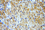STAC3 Antibody in Immunohistochemistry (Paraffin) (IHC (P))
