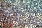 STAC3 Antibody in Immunohistochemistry (Paraffin) (IHC (P))