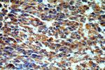 STAC3 Antibody in Immunohistochemistry (Paraffin) (IHC (P))