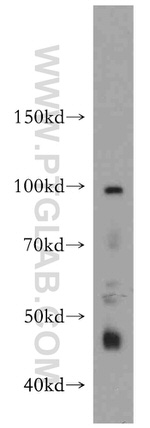 STAC3 Antibody in Western Blot (WB)