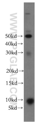 CCDC72 Antibody in Western Blot (WB)