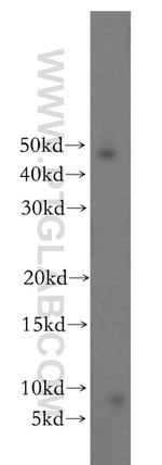CCDC72 Antibody in Western Blot (WB)