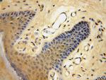 CCDC72 Antibody in Immunohistochemistry (Paraffin) (IHC (P))