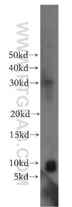 CCDC72 Antibody in Western Blot (WB)