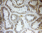 CCDC158 Antibody in Immunohistochemistry (Paraffin) (IHC (P))