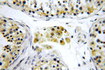 CCDC158 Antibody in Immunohistochemistry (Paraffin) (IHC (P))