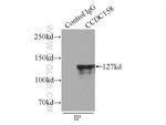 CCDC158 Antibody in Immunoprecipitation (IP)