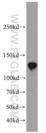 CCDC158 Antibody in Western Blot (WB)