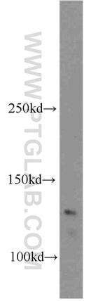 CCDC158 Antibody in Western Blot (WB)