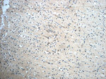 GLUT3 Antibody in Immunohistochemistry (Paraffin) (IHC (P))