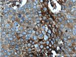 GLUT3 Antibody in Immunohistochemistry (Paraffin) (IHC (P))