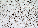 SNRPE Antibody in Immunohistochemistry (Paraffin) (IHC (P))
