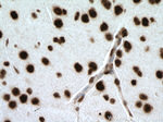 SNRPE Antibody in Immunohistochemistry (Paraffin) (IHC (P))