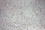 SNRPE Antibody in Immunohistochemistry (Paraffin) (IHC (P))