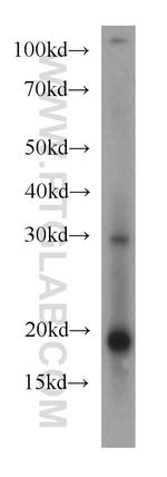 RNF181 Antibody in Western Blot (WB)