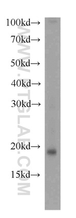 RNF181 Antibody in Western Blot (WB)