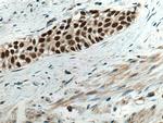 FOXA1 Antibody in Immunohistochemistry (Paraffin) (IHC (P))