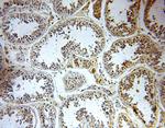 PIGM Antibody in Immunohistochemistry (Paraffin) (IHC (P))