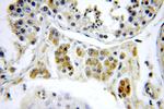 PIGM Antibody in Immunohistochemistry (Paraffin) (IHC (P))
