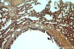 B3GNT5 Antibody in Immunohistochemistry (Paraffin) (IHC (P))