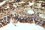 B3GNT5 Antibody in Immunohistochemistry (Paraffin) (IHC (P))