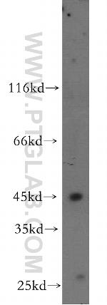 B3GNT5 Antibody in Western Blot (WB)