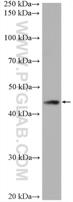B3GNT5 Antibody in Western Blot (WB)