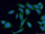 Fibulin-1 Antibody in Immunocytochemistry (ICC/IF)