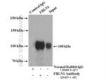 Fibulin-1 Antibody in Immunoprecipitation (IP)