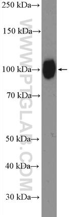 Fibulin-1 Antibody in Western Blot (WB)