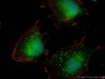 TMEM39A Antibody in Immunocytochemistry (ICC/IF)