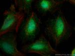 TMEM39A Antibody in Immunocytochemistry (ICC/IF)