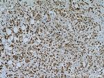 TMEM39A Antibody in Immunohistochemistry (Paraffin) (IHC (P))
