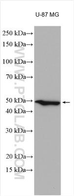 TMEM39A Antibody in Western Blot (WB)
