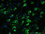 PSEN1 Antibody in Immunohistochemistry (PFA fixed) (IHC (PFA))