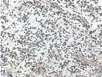 PSEN1 Antibody in Immunohistochemistry (Paraffin) (IHC (P))
