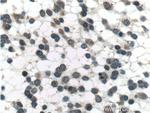 PSEN1 Antibody in Immunohistochemistry (Paraffin) (IHC (P))