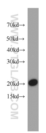 COPZ1 Antibody in Western Blot (WB)