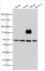 YIPF2 Antibody in Western Blot (WB)