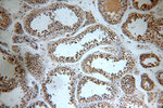 C5orf44 Antibody in Immunohistochemistry (Paraffin) (IHC (P))