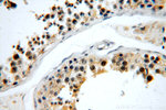 C5orf44 Antibody in Immunohistochemistry (Paraffin) (IHC (P))