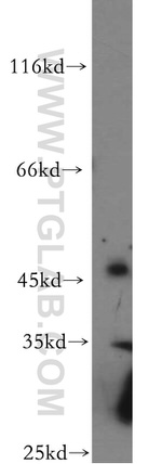 C5orf44 Antibody in Western Blot (WB)