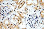 C5orf44 Antibody in Immunohistochemistry (Paraffin) (IHC (P))
