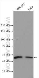 C5orf44 Antibody in Western Blot (WB)