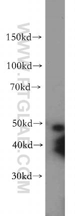 C5orf44 Antibody in Western Blot (WB)