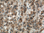 USP33 Antibody in Immunohistochemistry (Paraffin) (IHC (P))
