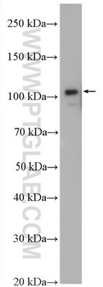 USP33 Antibody in Western Blot (WB)